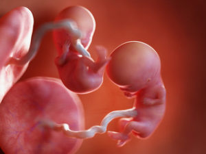 EARLY PREGNANCY A GOGO
