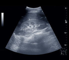 Ultrasonography
