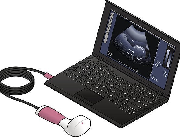 POINT OF CARE ULTRASOUND