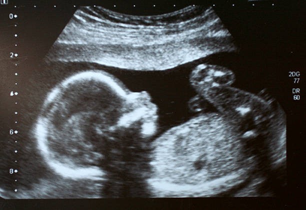 EARLY PREGNANCY A GOGO