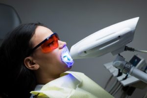 Best Teeth Whitening Product 2023
