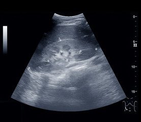 Abdominal Ultrasound Cheat Sheet For Student Sonographers