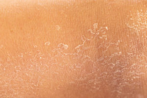 Best Cleansers for Acne Prone Skin