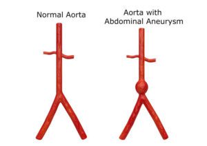 Abdominal Ultrasound Cheat Sheet For Student Sonographers