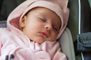 Removal Of Facial Birthmarks